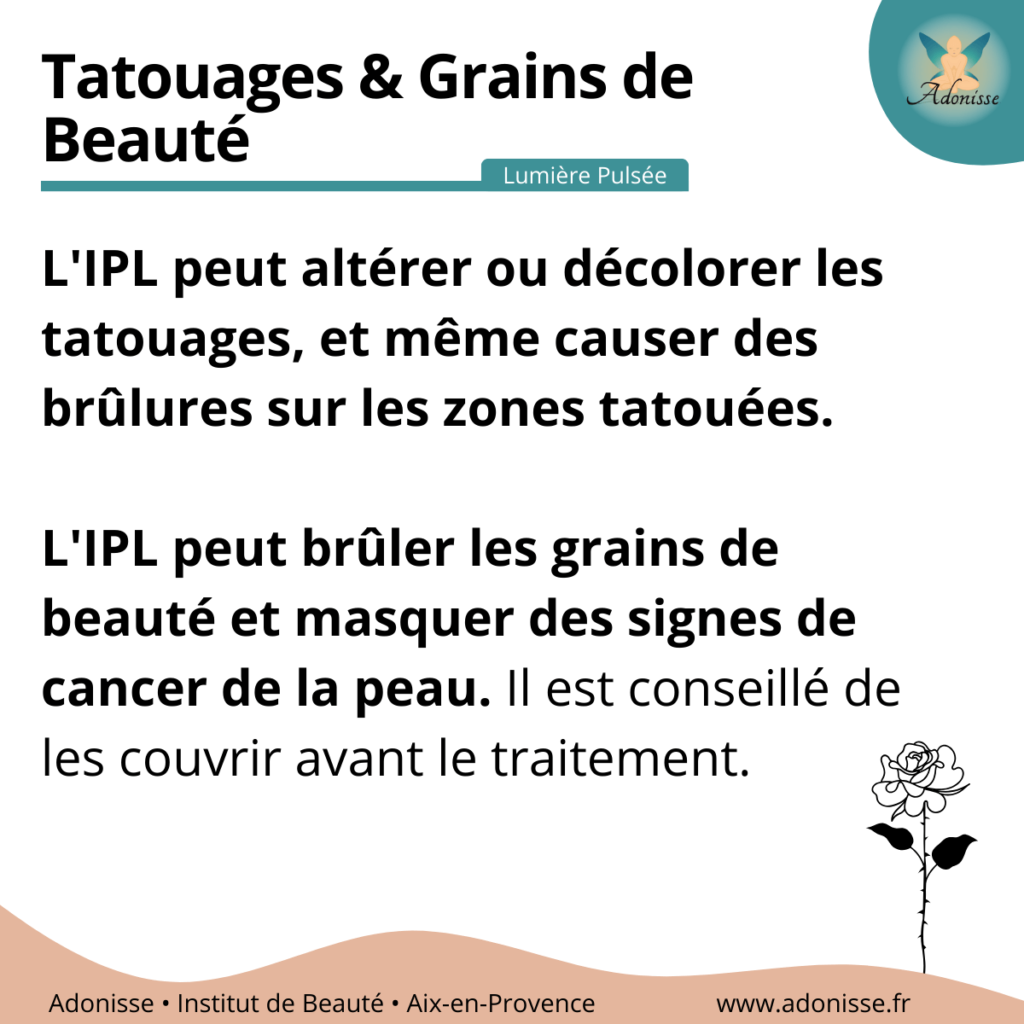 tatouages epilation lumiere