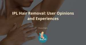 ipl hair removal user experiences