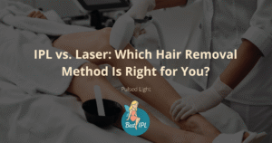 ipl vs laser best for you